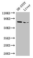 CHAT Antibody