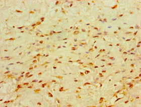 CHD1 Antibody