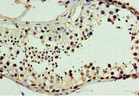 CHD2 Antibody