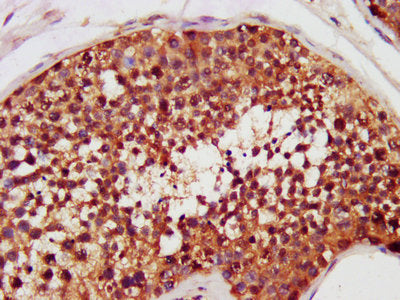 CHEK2 Antibody