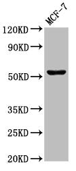 CHKA Antibody