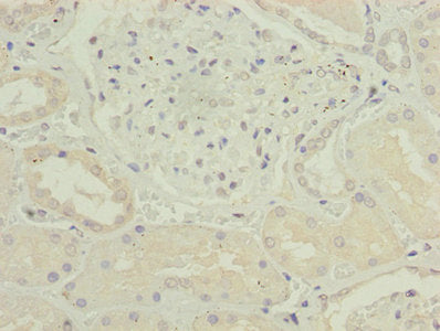 CKS2 Antibody