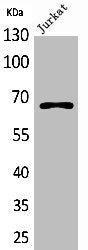 ESR1 Antibody