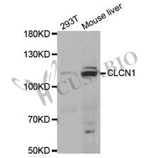 CLCN1 Antibody