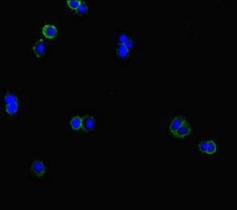 CLCN1 Antibody