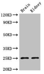CLDN10 Antibody