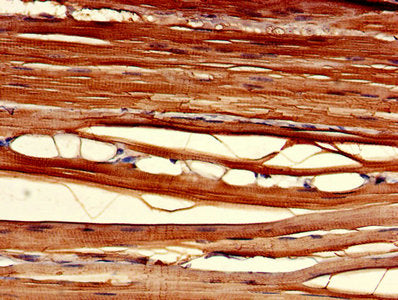 CLIC2 Antibody