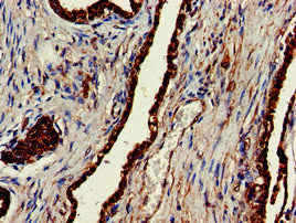 CLINT1 Antibody