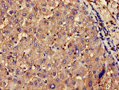 CNKSR2 Antibody