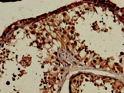 CNTNAP1 Antibody