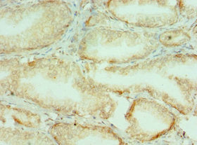 COL10A1 Antibody
