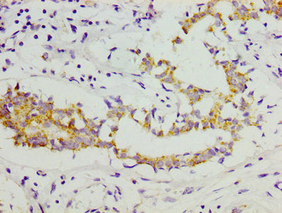 COL11A1 Antibody