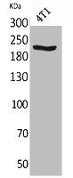 MYH1/MYH2/MYH3/MYH4/MYH6/MYH7/MYH8 Antibody