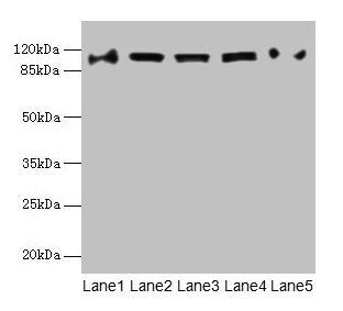 COPB1 Antibody