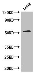 CORO1A Antibody