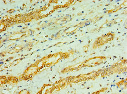 CPA1 Antibody