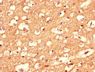CPLX1 Antibody