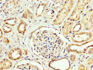 CPT2 Antibody