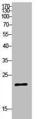 SRY Antibody