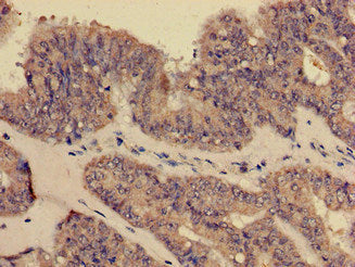 CR1 Antibody