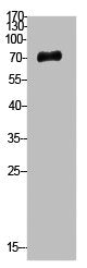 UBA52/RPS27A/UBB/UBC Antibody