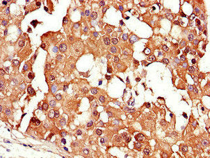 CRABP2 Antibody