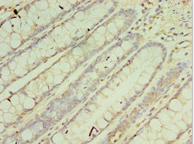 CRADD Antibody
