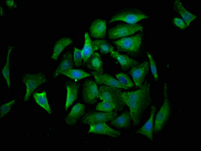 CRADD Antibody