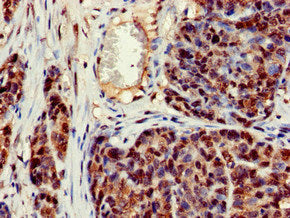 CRCP Antibody