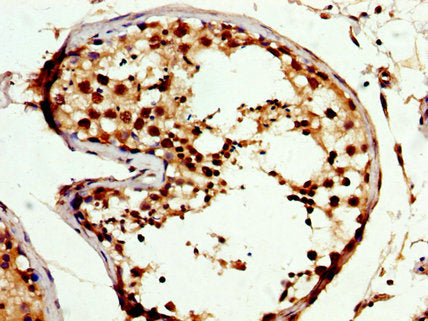 CREM Antibody