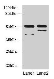 CRHR1 Antibody