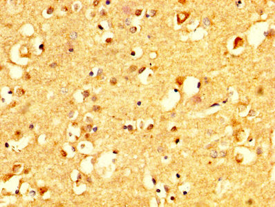 CRHR1 Antibody