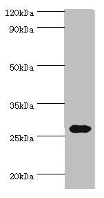 CRISP2 Antibody