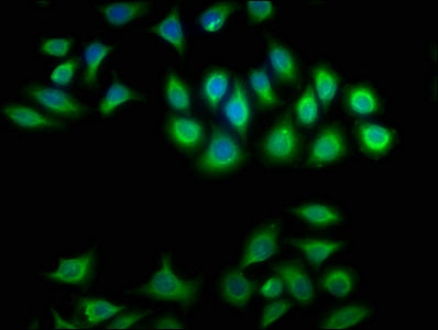 CRYBA1 Antibody