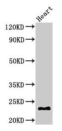 CRYBA4 Antibody