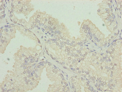 CS Antibody