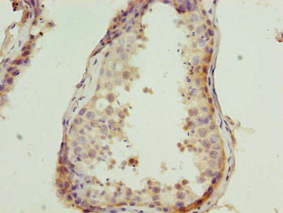CSAG1 Antibody