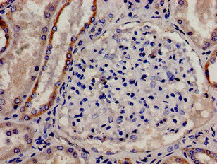 CSDE1 Antibody