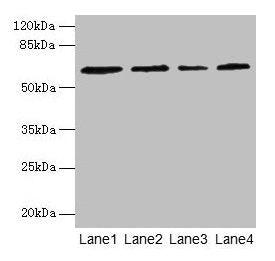 CSGALNACT2 Antibody