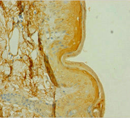 CSNK1A1 Antibody