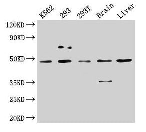 CSNK1D Antibody
