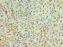 CST4 Antibody