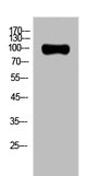 AR Antibody