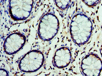 CST7 Antibody