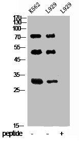 UBA52/RPS27A/UBB/UBC Antibody