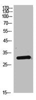 DKK1 Antibody