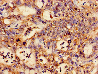 CTNND1 Antibody