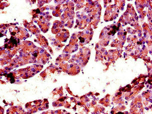 CTRL Antibody