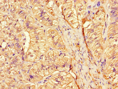CTSA Antibody