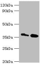 CTSK Antibody